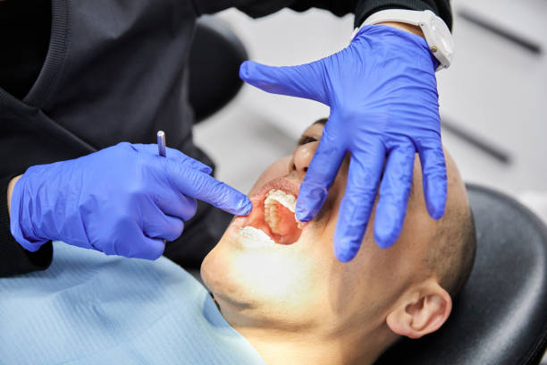 Best Emergency Dentist for Knocked-Out Tooth in Brazil, IN